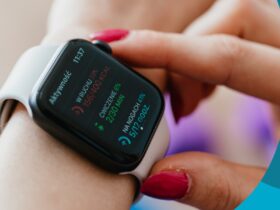 Smartwatch